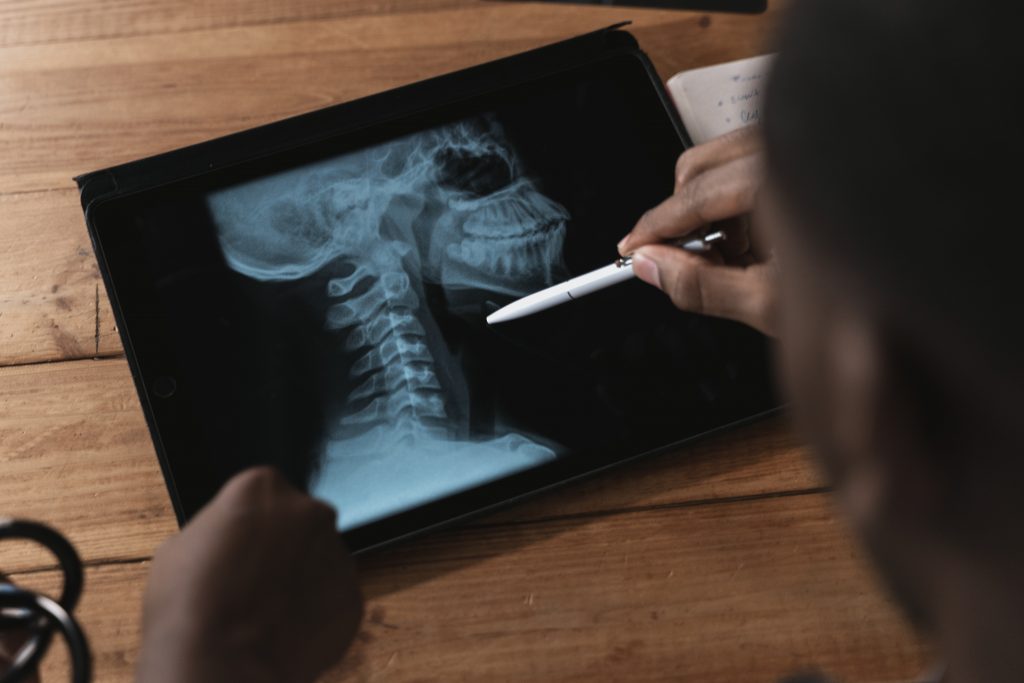 Лекар, преглеждащ рентгенова снимка на таблета си